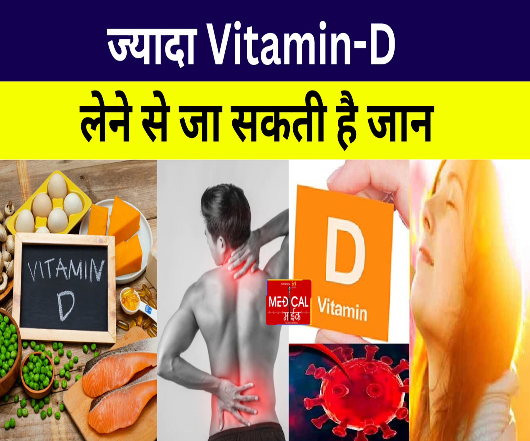 ज्यादा Vitamin D लेने से जा सकती है जान, शरीर में भर जाएंगे पत्थर, भारत में चाहिए सिर्फ इतना