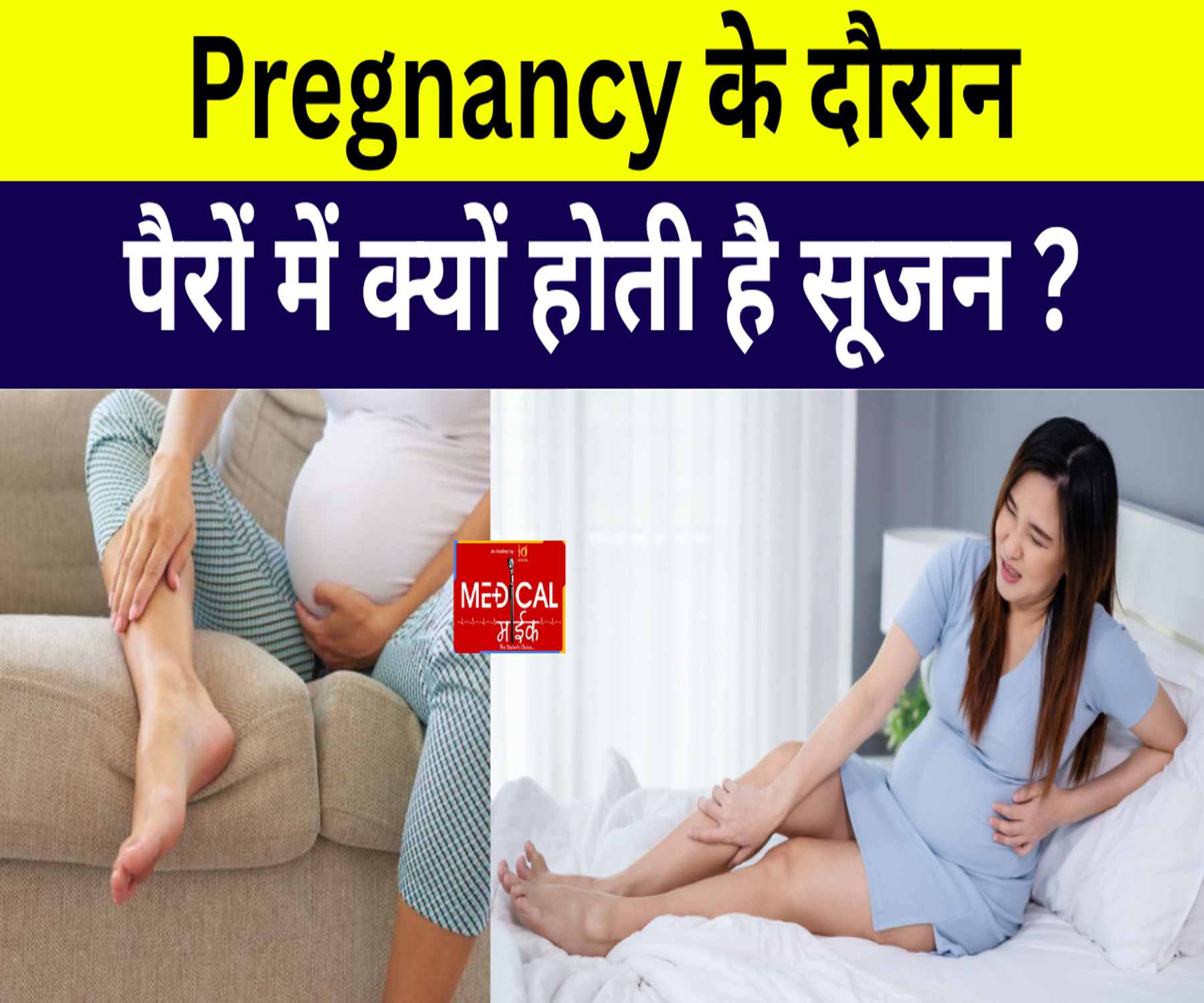 Pregnancy के दौरान पैरों में क्यों होती है सूजन ? क्या ये नॉर्मल है या फिर गंभीर ?