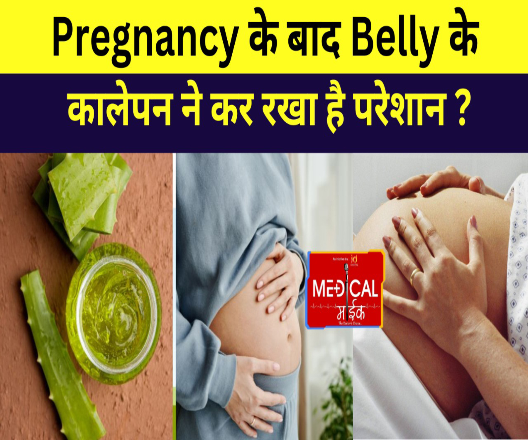 प्रेग्नेंसी के बाद Belly के कालेपन ने कर रखा है परेशान ? टेंशन की बात नहीं…