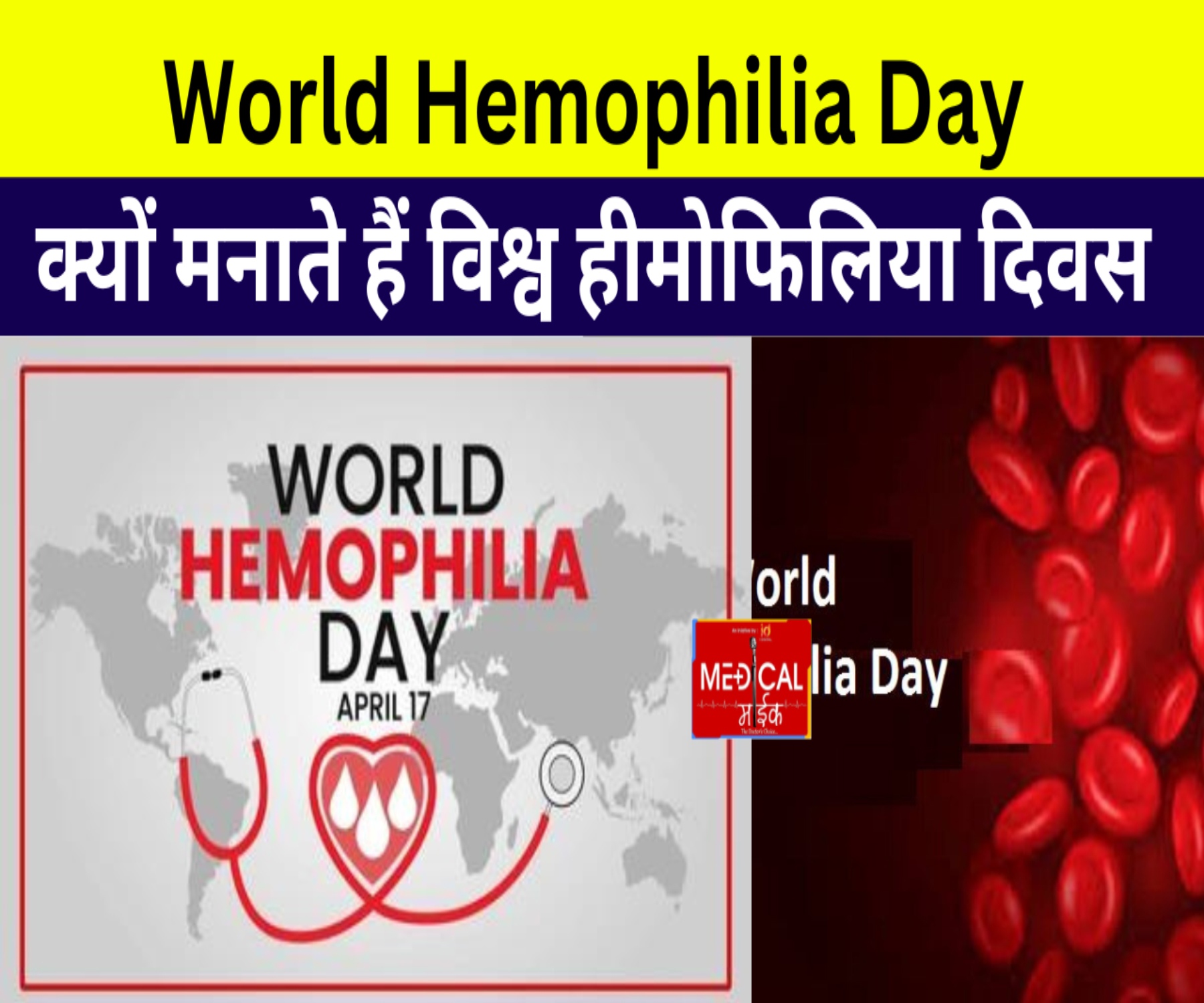 World Hemophilia Day 2023 : क्यों मनाते हैं विश्व हीमोफिलिया दिवस, क्या है इसका इतिहास और महत्व ?