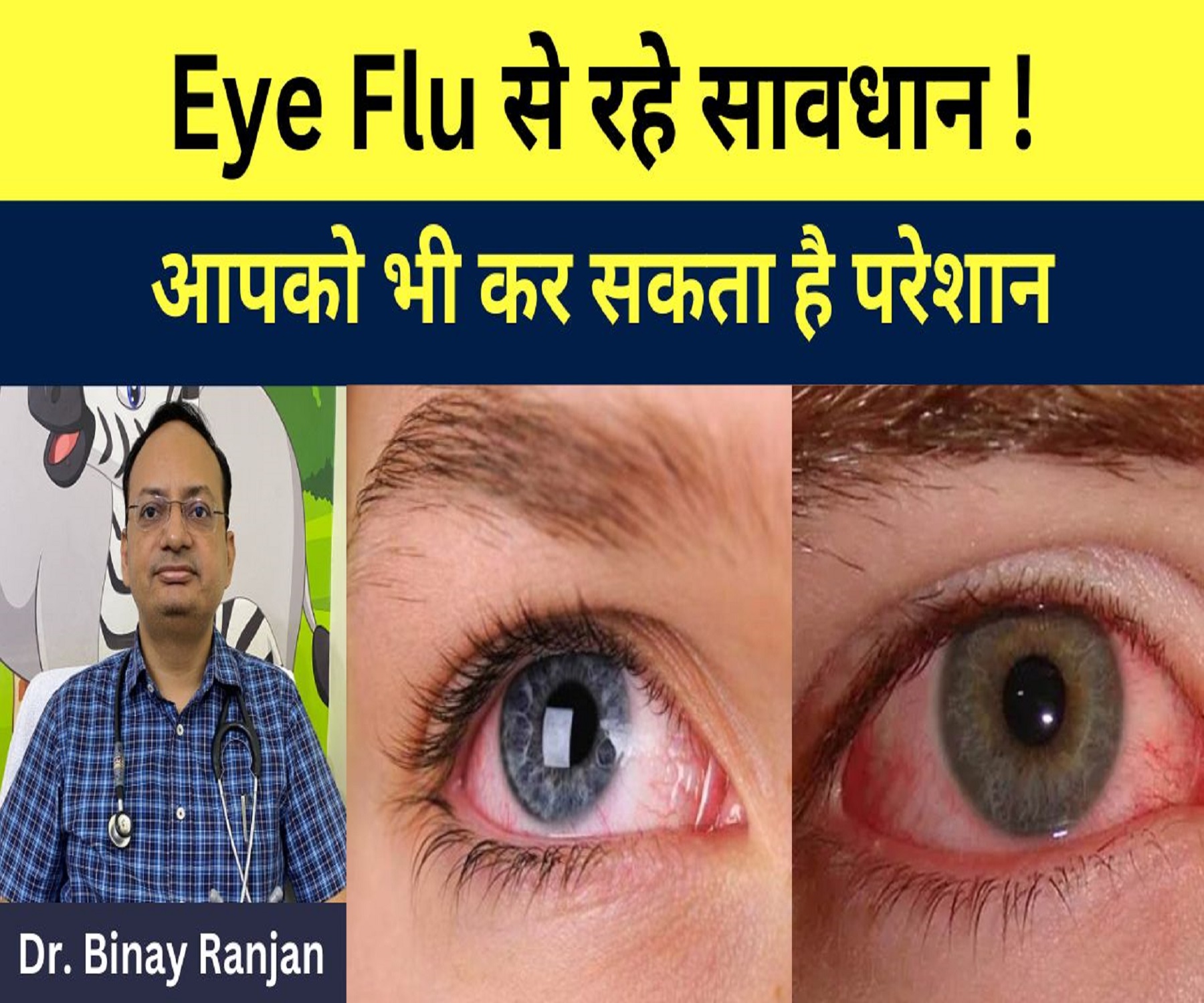 आई फ्लू से रहे सावधान । आपको भी कर सकता है परेशान । Dr. Binay  Ranjan