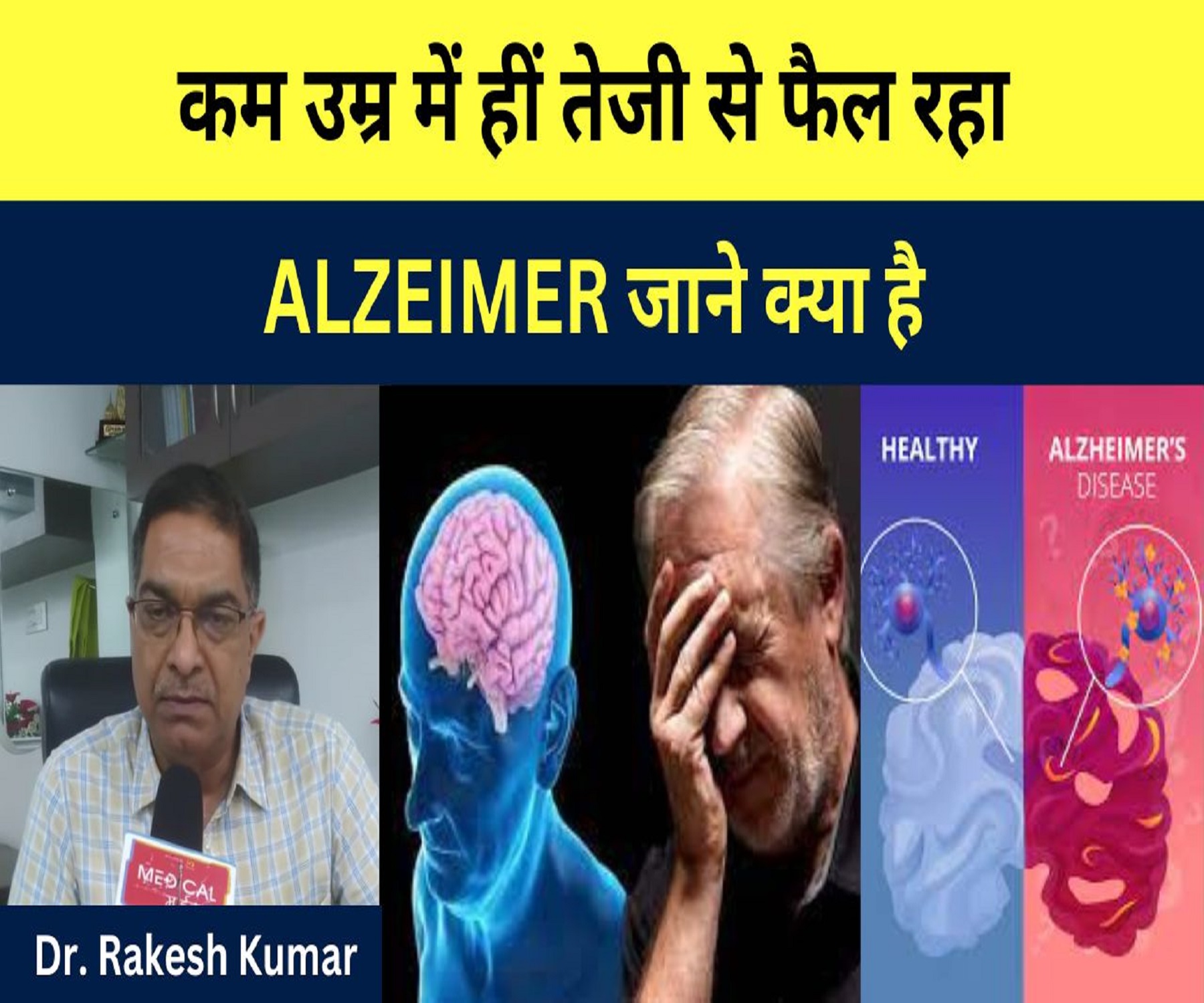 कम उम्र में हीं तेजी से फैल रहा ALZEIMER जाने क्या है? इसको रोकने का उपाय…Dr. Rakesh Kumar