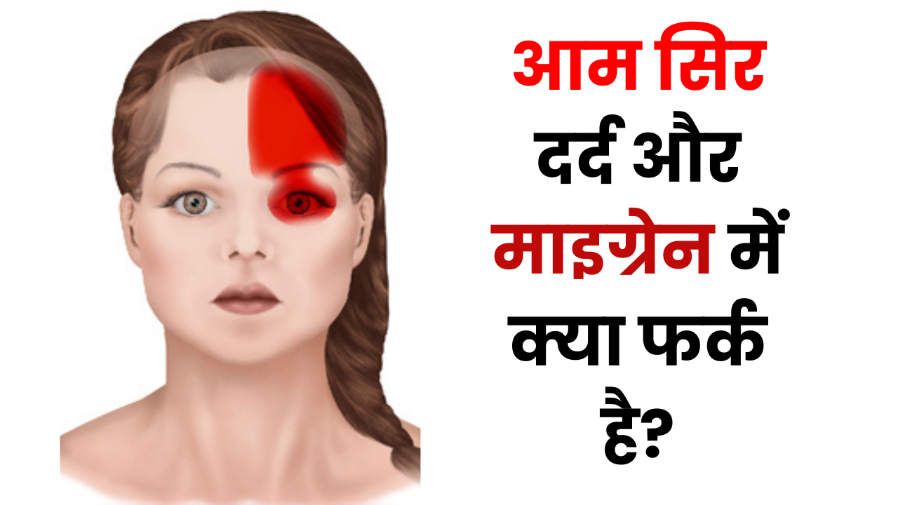 Migraine Pain: आम सिर दर्द और माइग्रेन में क्या फर्क है?